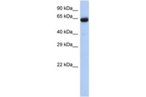 Western Blotting (WB) image for anti-Leucine Rich Repeat Transmembrane Neuronal 1 (LRRTM1) antibody (ABIN2463945) (LRRTM1 Antikörper)