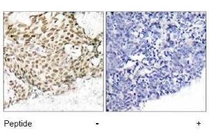 Image no. 1 for anti-Nibrin (NBN) (Ser343) antibody (ABIN197201) (Nibrin Antikörper  (Ser343))