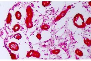 Anti-HSP110 / Heat Shock Protein 110 antibody IHC staining of human breast. (HSPH1 Antikörper)
