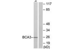 Western blot analysis of extracts from Jurkat cells, using BCA3 Antibody. (AKIP1 Antikörper  (AA 111-160))