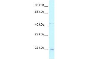 WB Suggested Anti-Twist1 Antibody Titration: 1. (TWIST1 Antikörper  (N-Term))