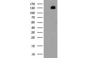 Western Blotting (WB) image for anti-Histone Deacetylase 6 (HDAC6) antibody (ABIN1498619) (HDAC6 Antikörper)