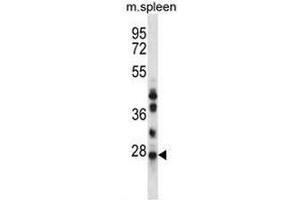 NQO2 Antibody (N-term) western blot analysis in mouse spleen tissue lysates (35µg/lane). (NQO2 Antikörper  (N-Term))