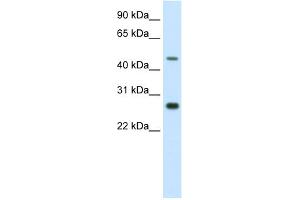 WB Suggested Anti-SPZ1 Antibody Titration:  2. (SPZ1 Antikörper  (C-Term))