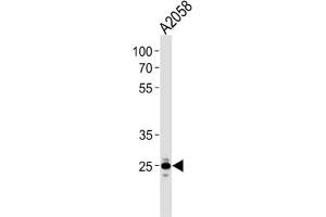 Western Blotting (WB) image for anti-Mitochondrial Ribosomal Protein L28 (MRPL28) antibody (ABIN3000729)