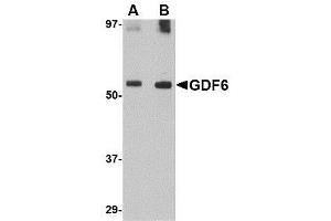 Image no. 1 for anti-Growth Differentiation Factor 6 (GDF6) (C-Term) antibody (ABIN342682) (GDF6 Antikörper  (C-Term))