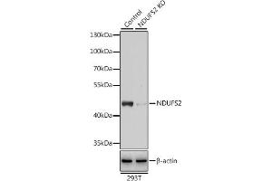 Western blot analysis of extracts from normal (control) and NDUFS2 knockout (KO) 293T cells, using NDUFS2 antibody (ABIN6133022, ABIN6144484, ABIN6144485 and ABIN7101413) at 1:3000 dilution. (NDUFS2 Antikörper  (AA 204-463))