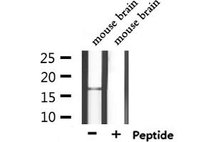 Western blot analysis of extracts from mouse brain, using CALML3 Antibody. (CALML3 Antikörper  (Internal Region))