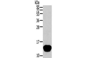 Western Blot analysis of Human normal liver tissue using THRSP Polyclonal Antibody at dilution of 1/400 (THRSP Antikörper)