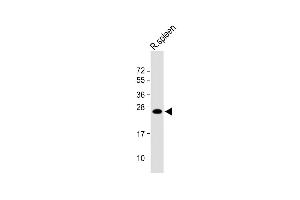 Anti-LIF Antibody (Center) at 1:1000 dilution + Rat spleen lysate Lysates/proteins at 20 μg per lane. (LIF Antikörper  (AA 72-101))