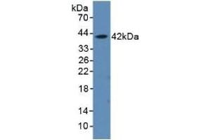 Detection of Recombinant aHSP, Rat using Polyclonal Antibody to Alpha-Hemoglobin Stabilizing Protein (aHSP)