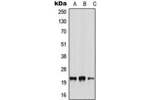 Western blot analysis of NRSN2 expression in A549 (A), NIH3T3 (B), H9C2 (C) whole cell lysates. (NRSN2 Antikörper  (Center))