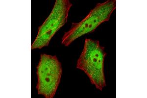 Fluorescent image of HeLa cells stained with RBX1 Antibody . (RBX1 Antikörper  (C-Term))