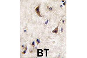 Formalin-fixed and paraffin-embedded human brain tissue reacted with PTPN5 polyclonal antibody  , which was peroxidase-conjugated to the secondary antibody, followed by DAB staining. (PTPN5 Antikörper  (N-Term))