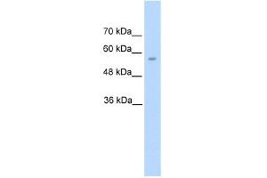 WB Suggested Anti-DDC Antibody Titration:  5. (DDC Antikörper  (N-Term))