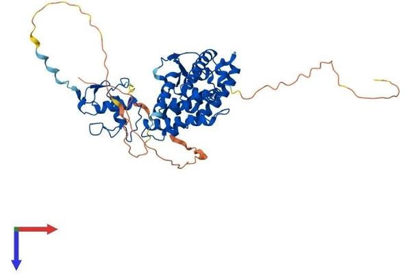 Retinoic Acid Receptor beta Protein (AA 1-455) (His tag)