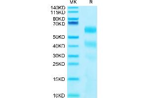 Human KIR3DL2 on Tris-Bis PAGE under reduced conditions. (KIR3DL2 Protein (AA 22-339) (His-Avi Tag))