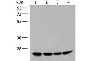Western blot analysis of Human fetal liver tissue HepG2 K562 and Raji cell lysates using DTYMK Polyclonal Antibody at dilution of 1:400 (DTYMK Antikörper)