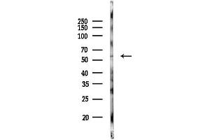 Western blot analysis of lysates from COLO205 cells(heat-shock 45 min treatment), using EIF2 Antibody at 1/1000 dilution.
