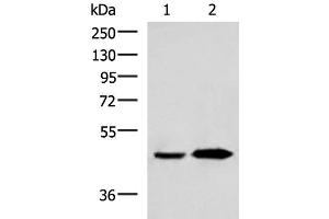 Western blot analysis of Human fetal liver tissue and Human liver tissue lysates using BHMT2 Polyclonal Antibody at dilution of 1:800