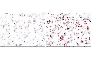 Immunocytochemistry analysis of HCC827 cells, untransfected (left) or transfected with GFP (right) using GFP antibody . (GFP Antikörper)