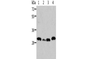 Western Blotting (WB) image for anti-STE20-Related Kinase Adaptor beta (STRADB) antibody (ABIN2429143) (STRADB Antikörper)