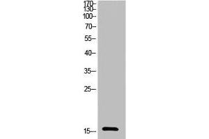 Western Blot analysis of HeLa cells using Acetyl-Ub (K27) Polyclonal Antibody (UBA52/RPS27A/UBB/UBC (acLys27) Antikörper)