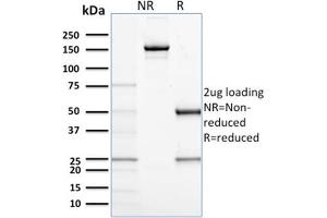 SDS-PAGE (SDS) image for anti-CD68 Molecule (CD68) antibody (ABIN6941241)