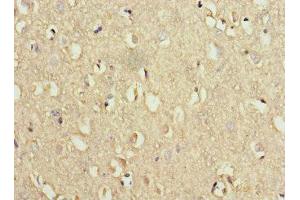 Immunohistochemistry of paraffin-embedded human brain tissue using ABIN7175774 at dilution of 1:100 (WDR6 Antikörper  (AA 1-200))