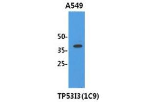 Image no. 1 for anti-Tumor Protein P53 Inducible Protein 3 (TP53I3) antibody (ABIN1490748) (TP53I3 Antikörper)