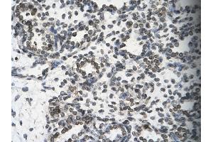 Immunohistochemistry (IHC) image for anti-SWI/SNF Related, Matrix Associated, Actin Dependent Regulator of Chromatin, Subfamily B, Member 1 (SMARCB1) (N-Term) antibody (ABIN2778301)