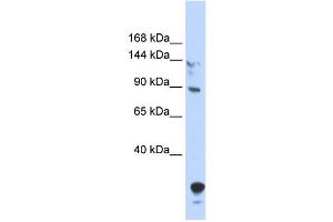 WB Suggested Anti-TULP4 Antibody Titration:  0.