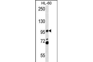 CS2 Antibody (C-term) (ABIN657066 and ABIN2846230) western blot analysis in HL-60 cell line lysates (35 μg/lane).