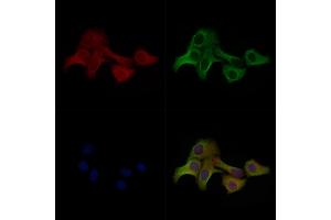 ABIN7093101 and ABIN7097255 staining Hela cells(heat shock treatment) by IF/ICC. (MLKL Antikörper  (pThr349))
