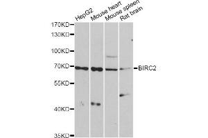 Western blot analysis of extracts of various cell lines, using BIRC2 antibody (ABIN6292780) at 1:1000 dilution. (BIRC2 Antikörper)