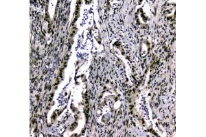 IHC testing of FFPE rat testis tissue with UBA2 antibody at 1ug/ml. (UBA2 Antikörper)