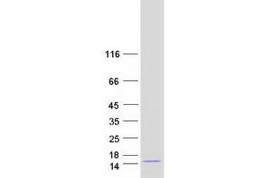 Mannosidase, beta A, Lysosomal-Like (MANBAL) (Transcript Variant 1) protein (Myc-DYKDDDDK Tag)