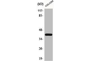 Western Blot analysis of COLO205 cells using Brp16 Polyclonal Antibody (FAM203B Antikörper  (Internal Region))
