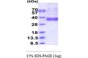 SDS-PAGE (SDS) image for ADP-Ribosyltransferase 4 (Dombrock Blood Group) (ART4) (AA 47-285) protein (His tag) (ABIN6388163) (ART4 Protein (AA 47-285) (His tag))