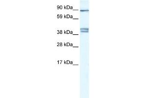 WB Suggested Anti-CLCNKB Antibody Titration:  0. (CLCNKB Antikörper  (C-Term))