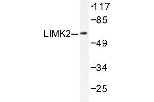 Image no. 1 for anti-LIM Domain Kinase 2 (LIMK2) antibody (ABIN265509) (LIMK2 Antikörper)