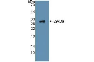 Detection of Recombinant ITGa2, Human using Polyclonal Antibody to Integrin Alpha 2 (ITGa2) (ITGA2 Antikörper  (AA 170-361))