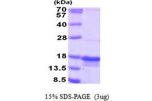 SDS-PAGE (SDS) image for Peptidyl-tRNA Hydrolase Domain Containing 1 (PTRHD1) (AA 1-140) protein (His tag) (ABIN5853886)