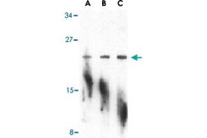 Western blot analysis of PTRH2 in A-20 cell lysate with PTRH2 polyclonal antibody  at (A) 1, (B) 2, and (C) 4 ug/mL . (PTRH2 Antikörper  (N-Term))