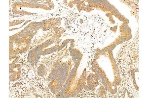 anti-phosphoprotein Associated with Glycosphingolipid Microdomains 1 (PAG1) (Internal Region) antibody
