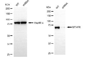 Western blotting analysis using MTHFR antibody (ABIN7799391). (Rekombinanter MTHFR Antikörper)