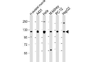 All lanes : Anti-Vinculin at 1:2000 dilution Lane 1: human skeletal muscle lysate Lane 2: A431 whole cell lysate Lane 3: Hela whole cell lysate Lane 4: mouse kidney lysate Lane 5: PC-12 whole cell lysate Lane 6: HepG2 whole cell lysate Lysates/proteins at 20 μg per lane. (Vinculin Antikörper  (AA 903-937))