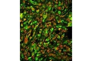 Immunofluorescence (IF) image for anti-Protein tyrosine Phosphatase Type IVA, Member 2 (PTP4A2) antibody (ABIN3002826) (PTP4A2 Antikörper)