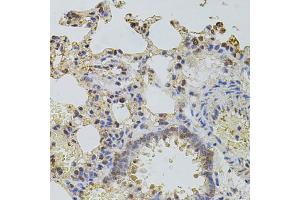Immunohistochemistry of paraffin-embedded rat lung using PLK4 antibody. (PLK4 Antikörper)
