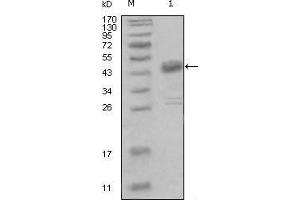 Western blot analysis using DDR1 mouse mAb against truncated MBP-DDR1 recombinant protein (1).